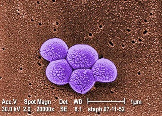 What is the ICD-9 code for MRSA?